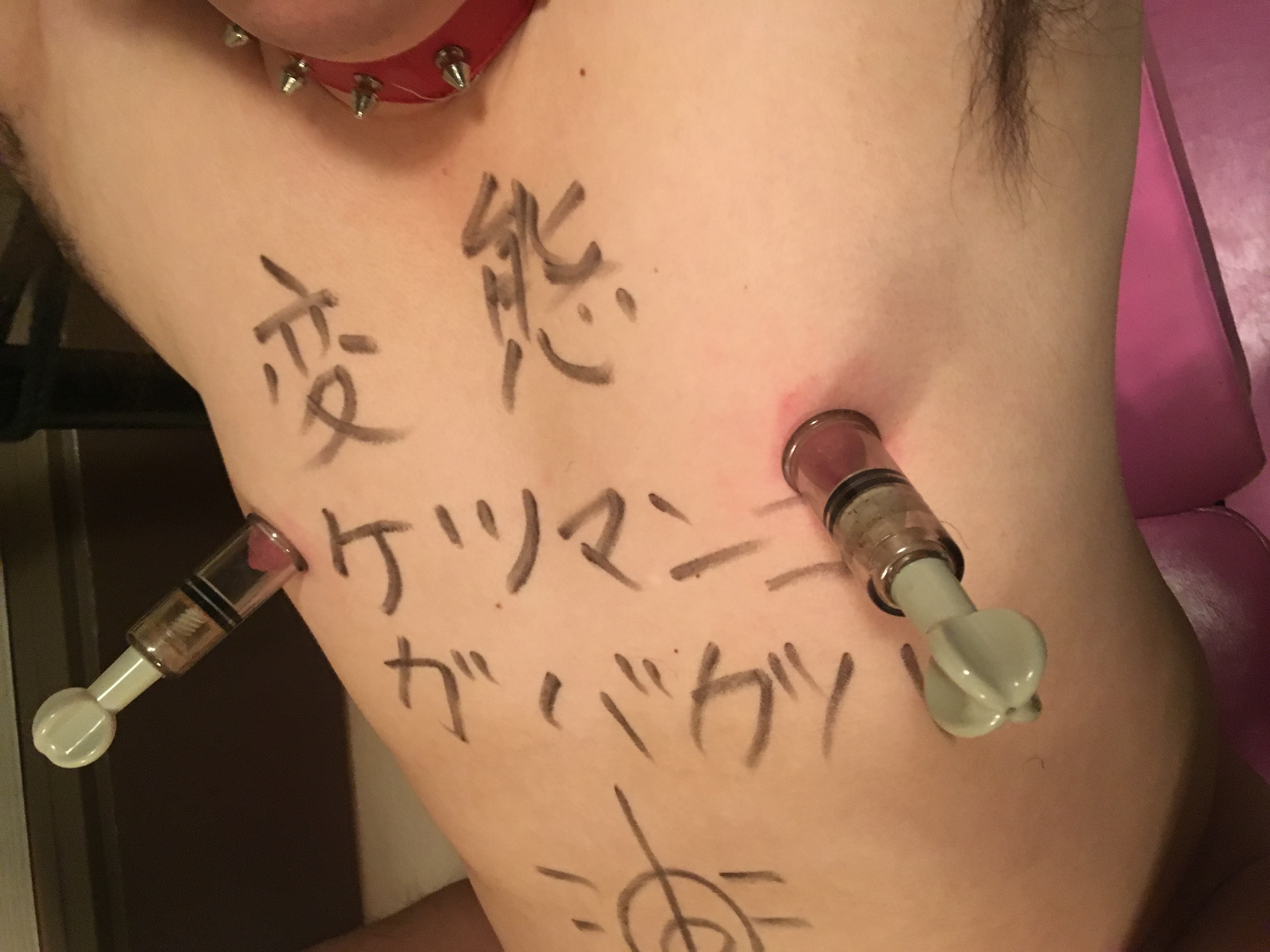 sm 乳首肥大 